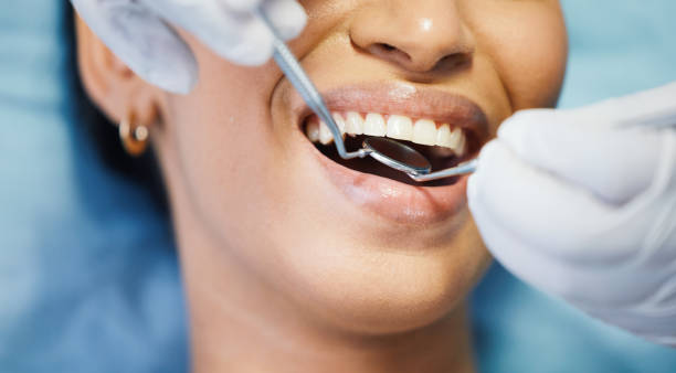 Best Emergency Treatment for Dental Infections or Abscesses in Rosemount, OH