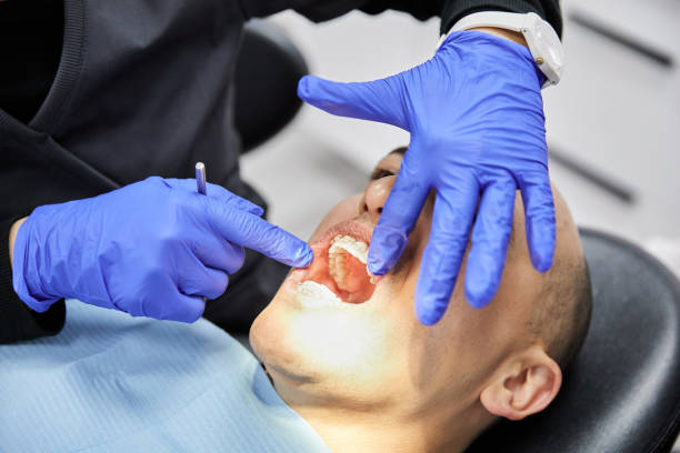 Best Emergency Tooth Extraction in Rosemount, OH