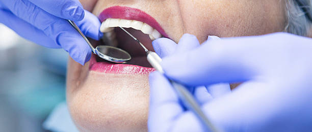 Best Emergency Gum Treatment in Rosemount, OH